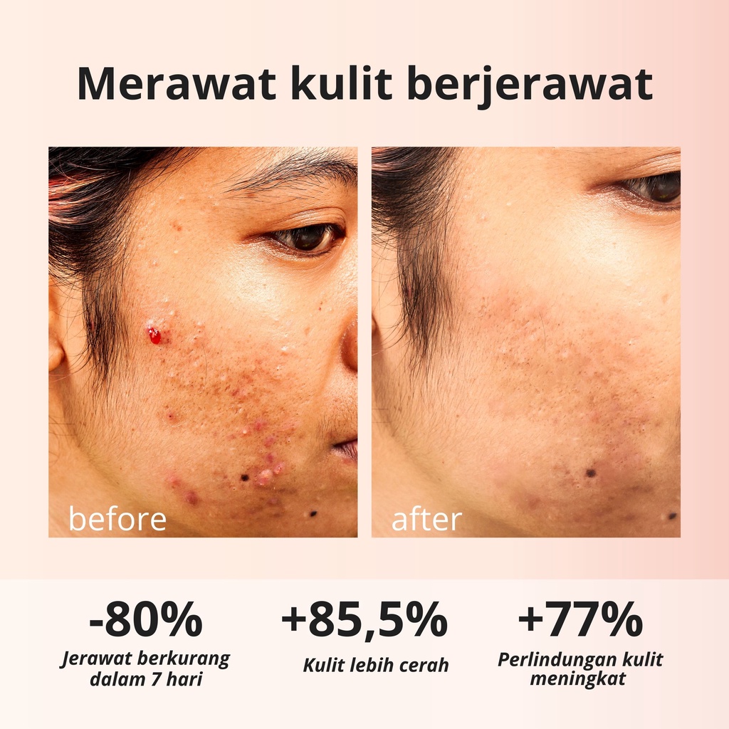 Lauralee Salmon DNA Sabun Wajah & Tubuh Pemutih 2in1 1 Box isi 2pcs Bright & Acne-8