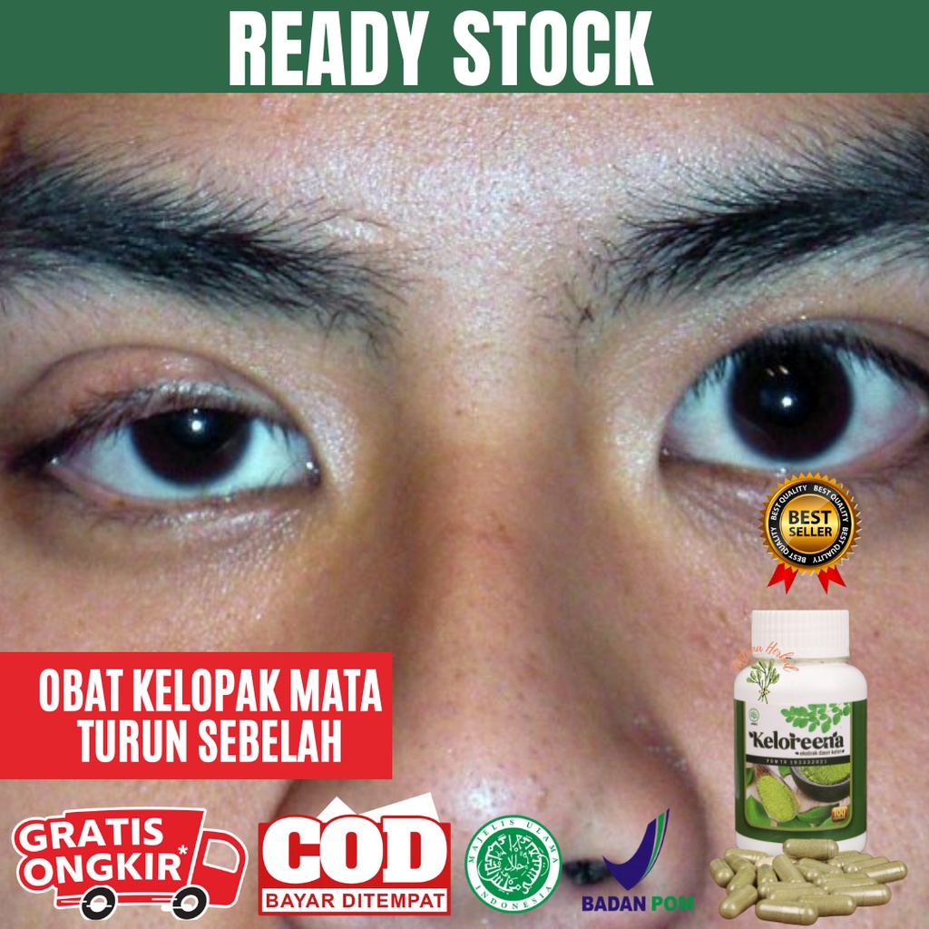 Keloreena - Obat Kelopak Mata Turun, Kelopak Mata Turun Sebelah, Syaraf Mata Lelah, Mata Berlemak