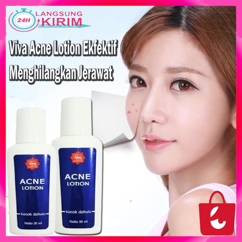 [Original] Viva Acne Lotion Ekfektif Menghilangkan Jerawat Obat Jerawat 30 ml