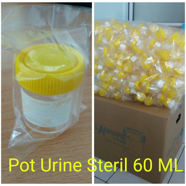 Pot urine steril