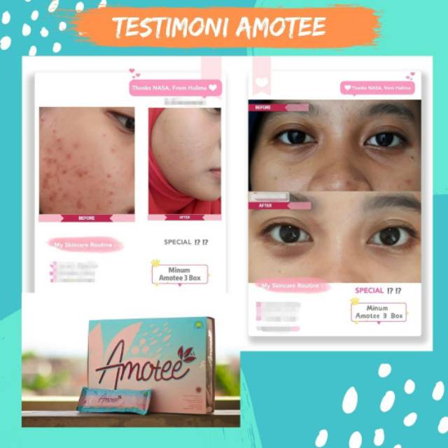 Amotee Suplemen Kecantikan Pencerah Wajah Collagen Kesehatan dan Kecantikan Kulit