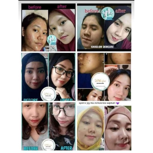 ISNA Glow Skincare Pemutih Wajah Terampuh BPOM 100% Original