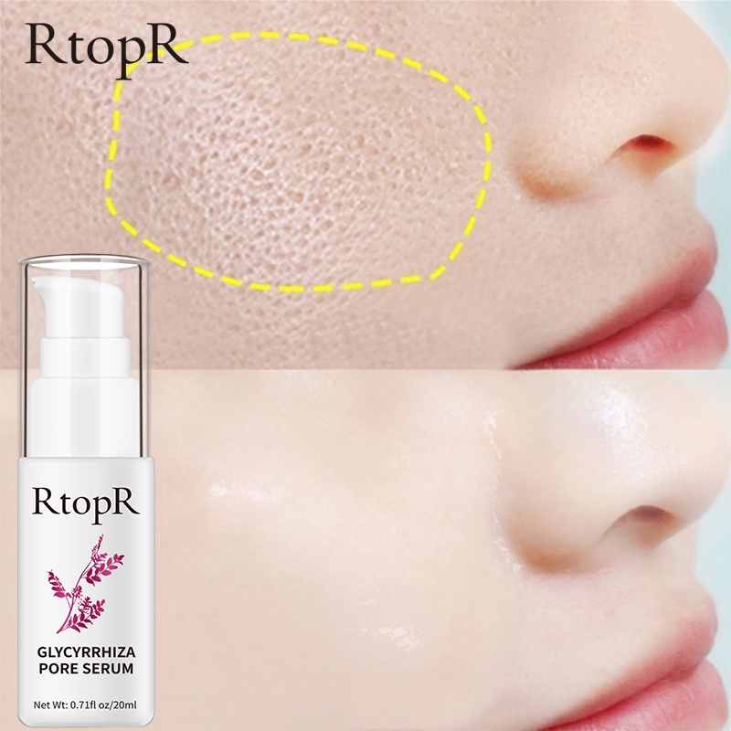 [BPOM]RtopR  Glycyrrhiza  Serum Perbaikan Pori Wajah  Kolagen  Anti-kerut  Minyak Krim Pemutih  Kontrol Menghidrasi Efektif Mengecilkan Pori-pori 20ml