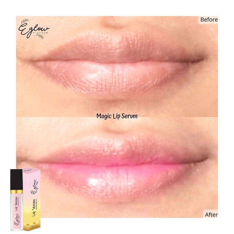 PROMO LIP SERUM EGLOW PLATINUM / MAGIC LIP SERUM EGLOW / LIP SERUM BIBIR / MAGIC LIP SERUM / SERUM BIBIR PECAH PECAH / SERUM BIBIR / OBAT BIBIR PECAH PECAH