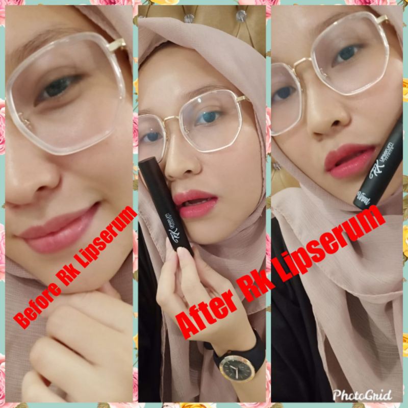 COD RK LIPSERUM BARU!!! ORIGINAL BPOM - CEWEK COWOK BISA PAKAI, PEROKOK, BIBIR GELAP HITAM KERING