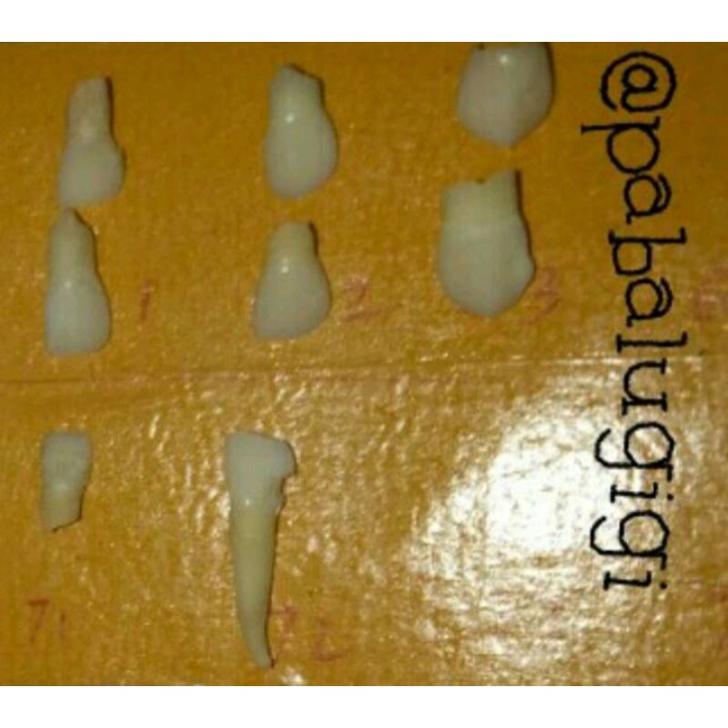 ⚠️JUAL MURAH GIGI Buka Kavum MOLAR RAHANG BAWAH GIGI PEDO ANAK Gigi Praktikum⚠️