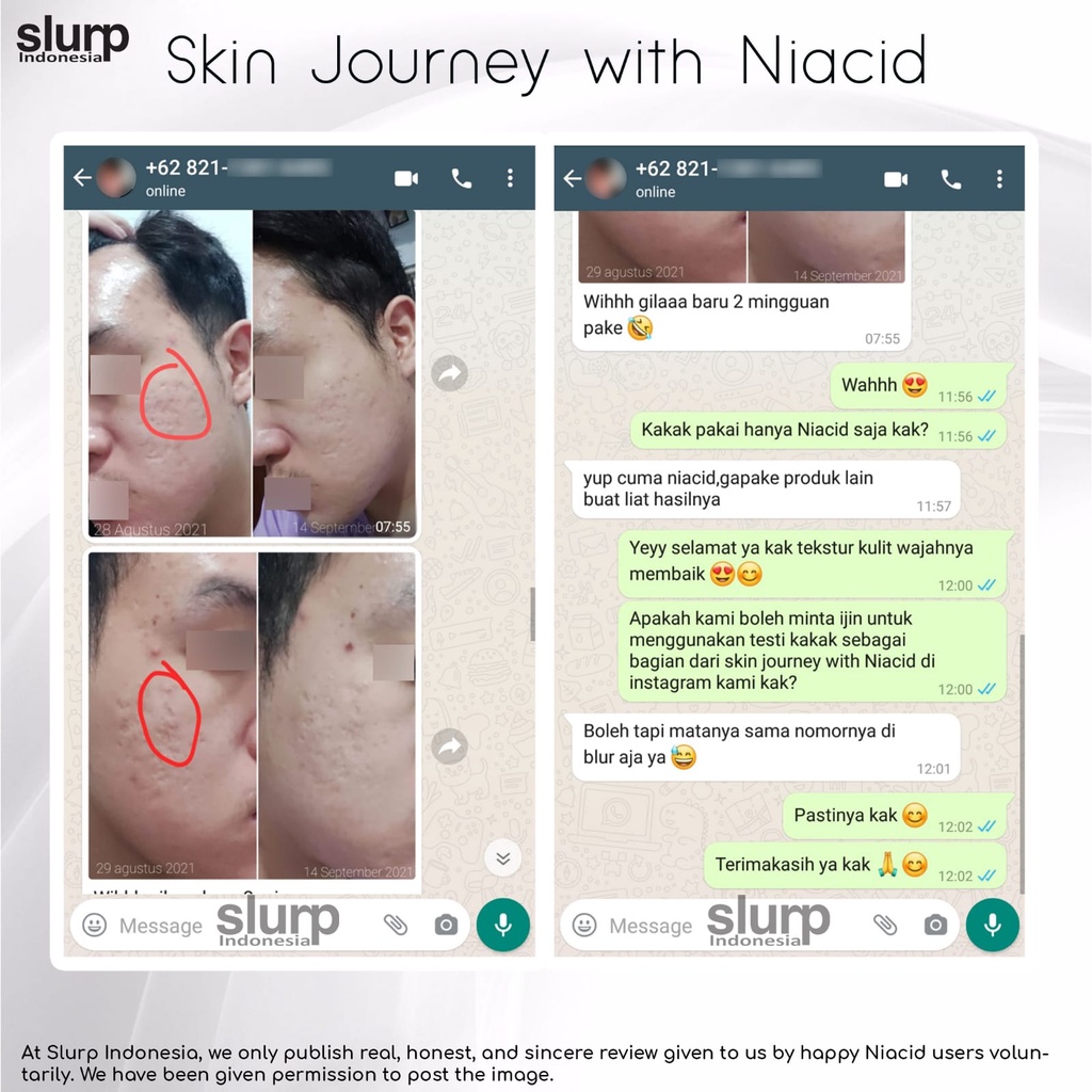 Niacid by Slurp Laboratories Korea All in One Face Serum BPOM Approved Bergaransi Asli-5