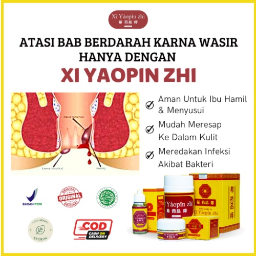 XI YAOPIN ZHI Herbal Salep Oil Kapsul Bantu Atasi Nyeri Ambeyen Ambeien Wasir Kempes Cepat Tanpa Operasi (COD)