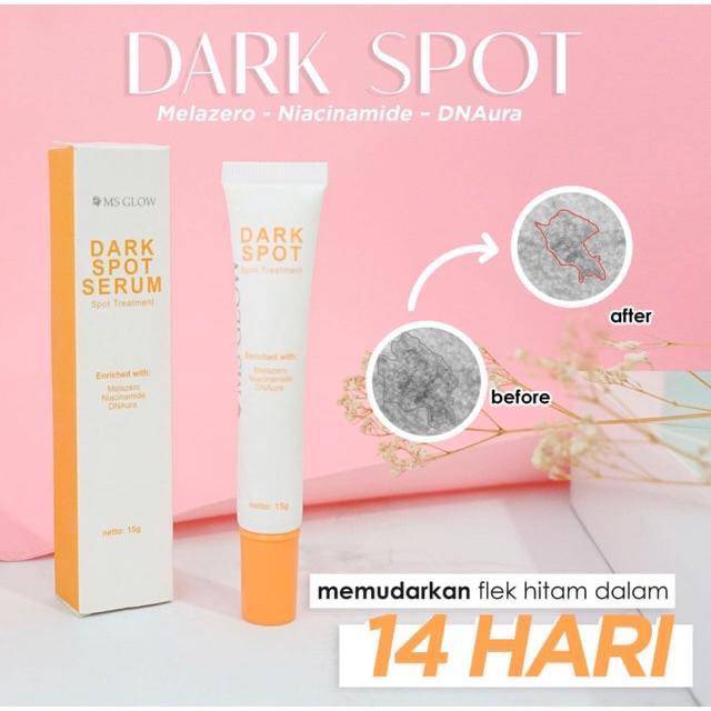 

Dark spot