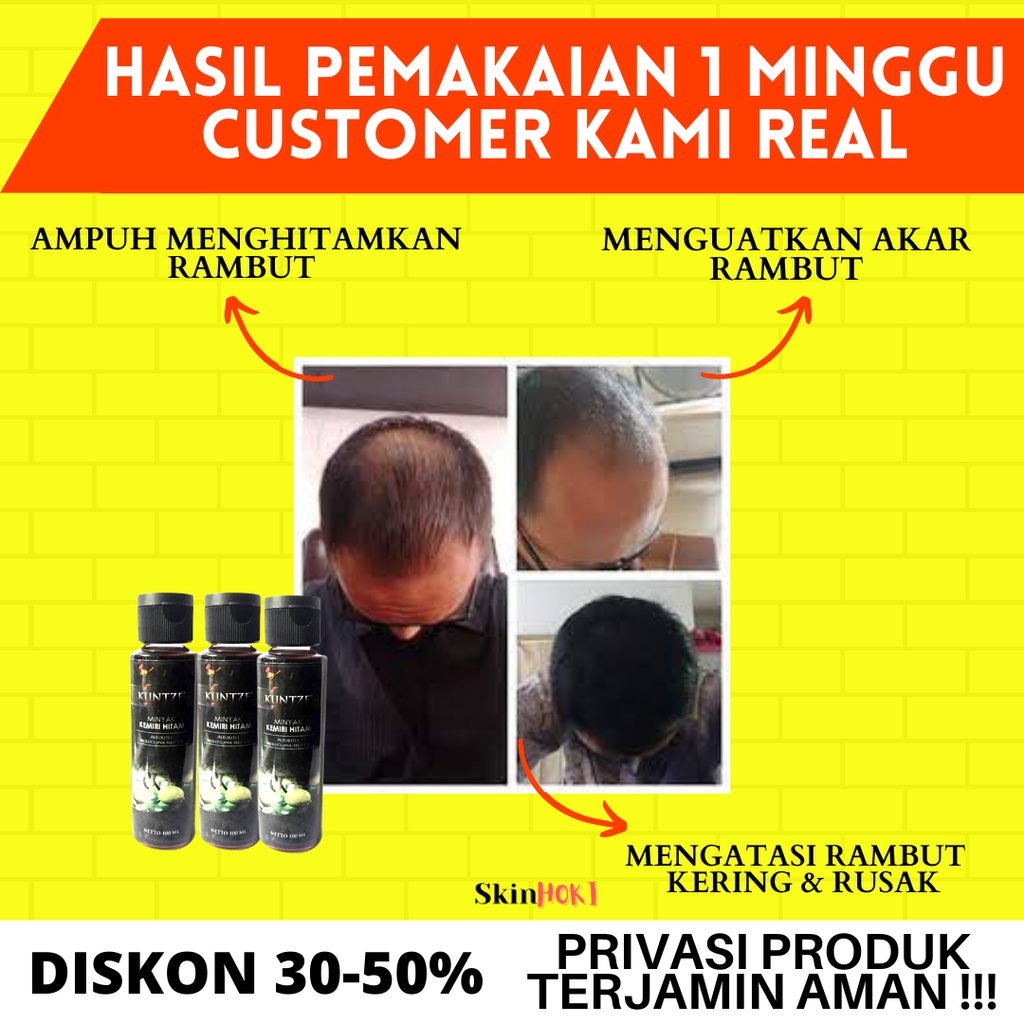 MINYAK KEMIRI PENUMBUH RAMBUT PENGHITAM ALIS MINYAK KEMIRI HITAM KUNTZE 100ML PENGHITAM RAMBUT ORIGINAL BPOM