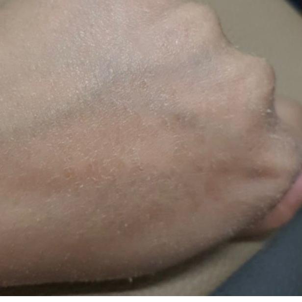 ☛ peeling badan l-glow / body serum luxury lglow/ KEMASAN BARU ☜