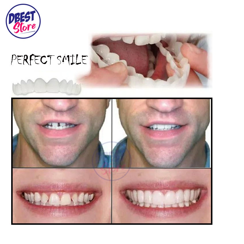 [ COD ] ORIGINAL 100% SNAP ON SMILE AUTHENTIC / GIGI PALSU SEPASANG ATAS BAWAH