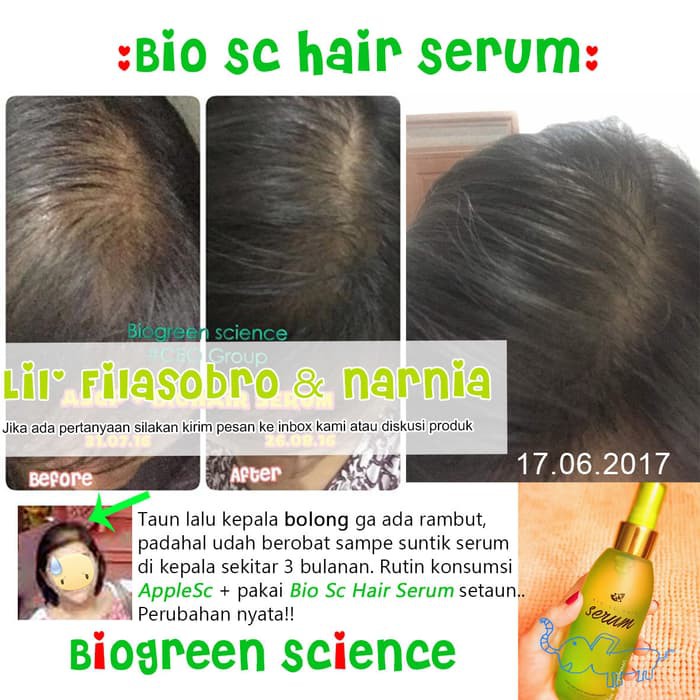 Flash Deal Biogreen Science Bio Sc Hair Serum Asli /Perawatan Tubuh - Perawatan Rambut - Pewarna