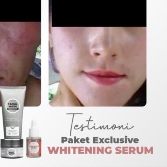 ➯ BENINGS SKINCARE BY DR.OKY PRATAMA PAKET EXCLUSIVE BENINGS CLINIC | BENINGSCLINIC | BENING PAKET F
