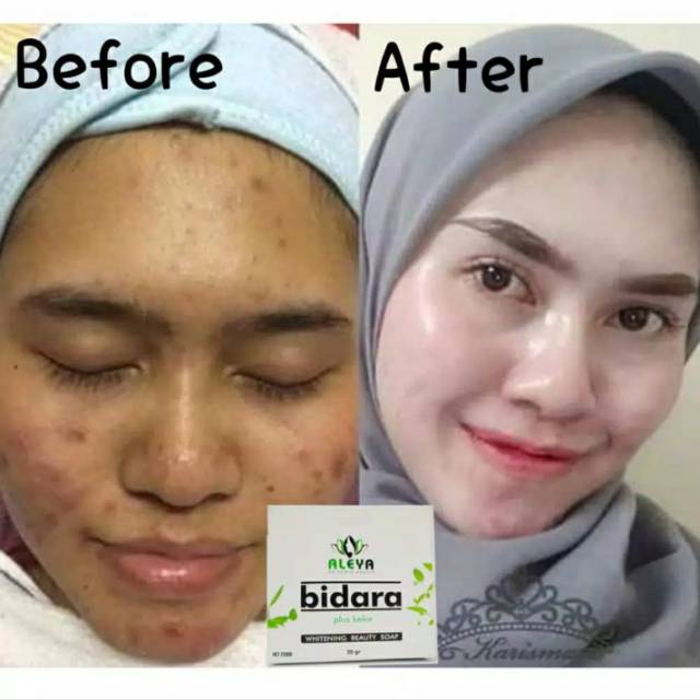 Sabun Pemutih Wajah Glowing Pencerah Kulit Muka (BPOM)