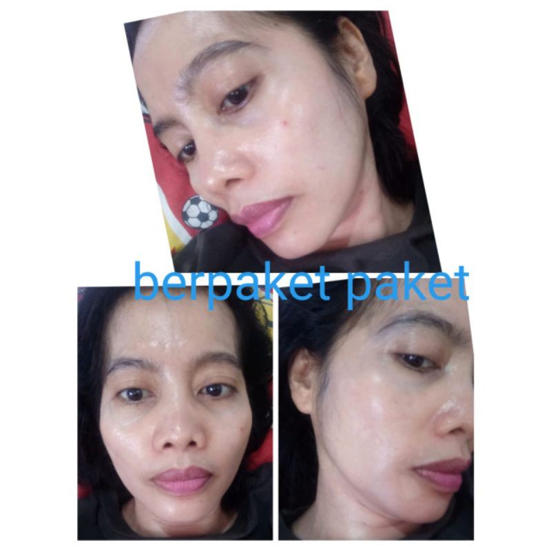 skincare probeauty sensitif