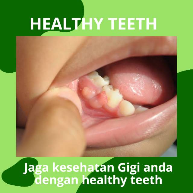 Healthy Teeth Shopee Indonesia