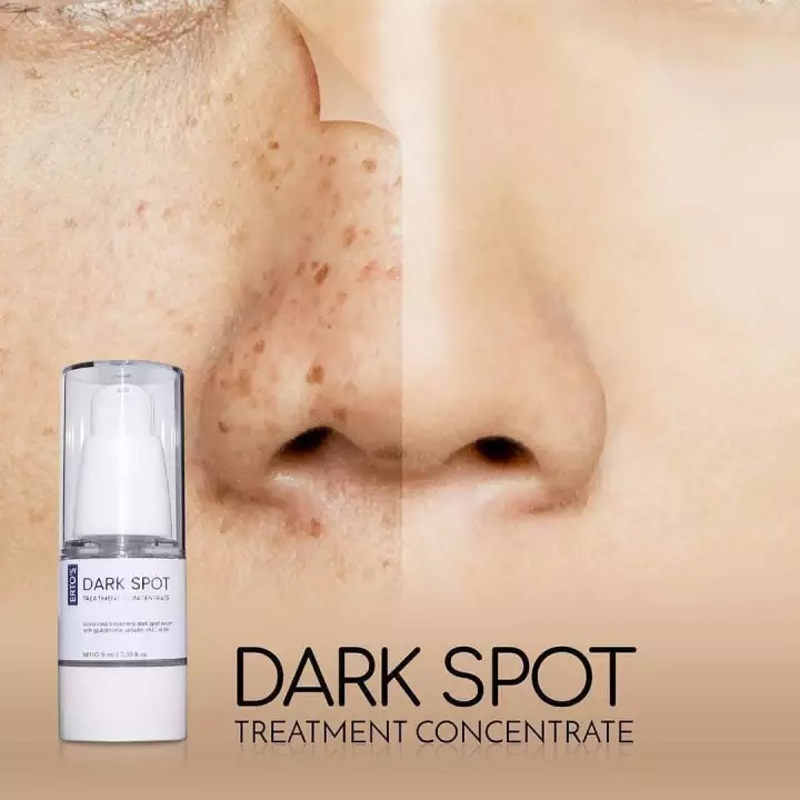 [ORI] Dark Spot Treatment Concentrate | Serum Whitening Agent Membasmi Flek Hitam di Wajah