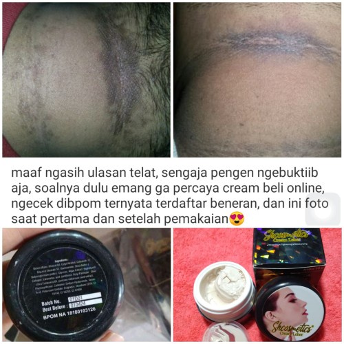 [COD] Cream Pemutih Leher dengan Kandungan Alpha Arbutin Mencerahkan dan Memutihkan Kulit Secara Merata by SH Cosmetics BPOM