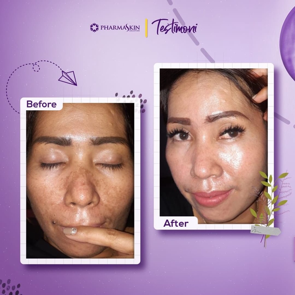 Pharmaskin Paket Night Treatment Flek Menahun-4
