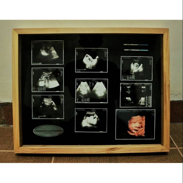 Pigura Foto USG dari Kayu Jati Belanda