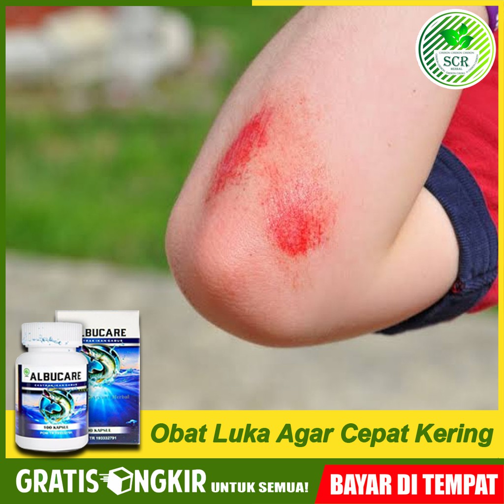 

obat herbal luka agar cepat kering Albucare Almbumin 100% original bisa cod