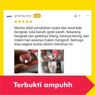 Salep Obat Gatal Eksim Kering Basah Menahun Paling Ampuh Kulit Gatel Kurap Kudis Selangkangan Jamur-2
