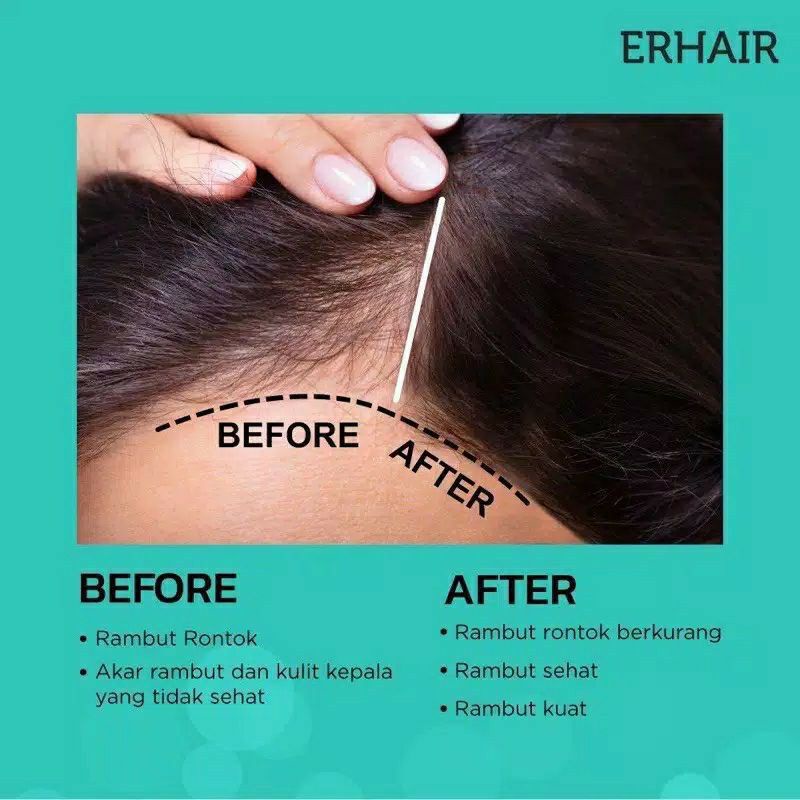 Erha Hair Grow Series : Shampoo | Tonic | Serum