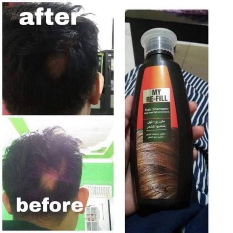 SHAMPO PENUMBUH RAMBUT DAN CEPAT PANJANG