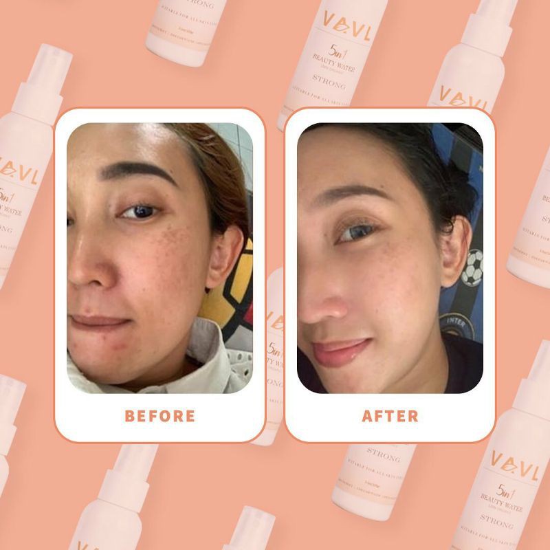 Vavl Beaute 1 Paket Package (Free pouch & gift)-6
