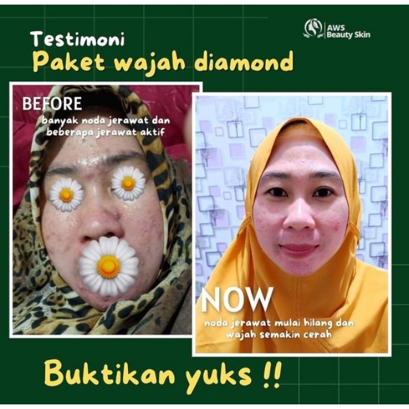 Paket perawatan wajah berkwalitas super.-2