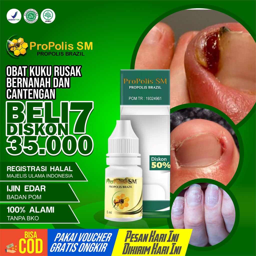 Jual Obat Kuku Rusak Dan Berjamur Cantengan Bengkak Bernanah Obat