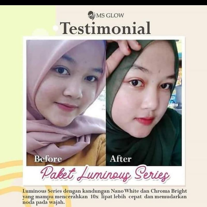 MS GLOW PAKET WAJAH  (WHITENING/LUMINOUS/ULTIMATE/ACNE/WHITE CELL DNA) FREE GIFT-7