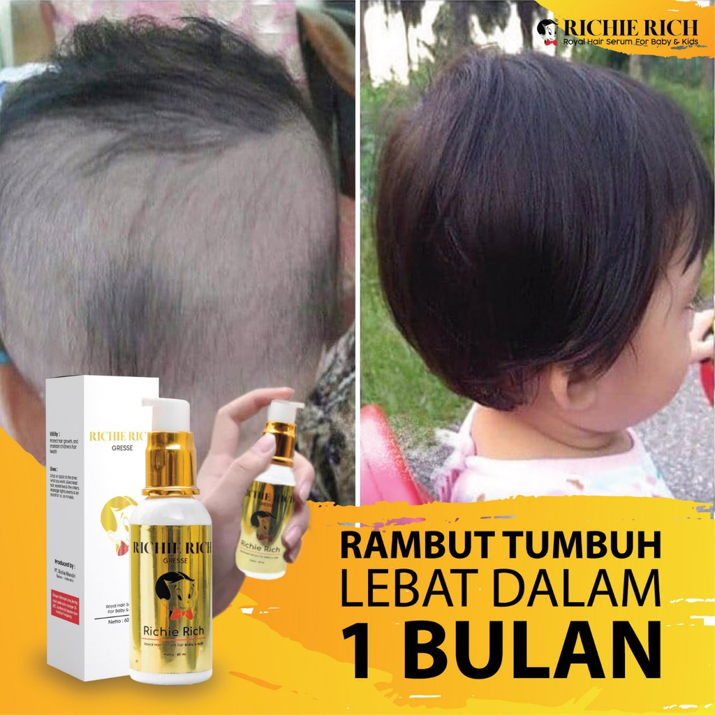 Nu Naima Royal Richy Penumbuh Rambut Bayi Anak Dari Minyak Kemiri Jahe Argan Cegah Rontok Shopee Indonesia