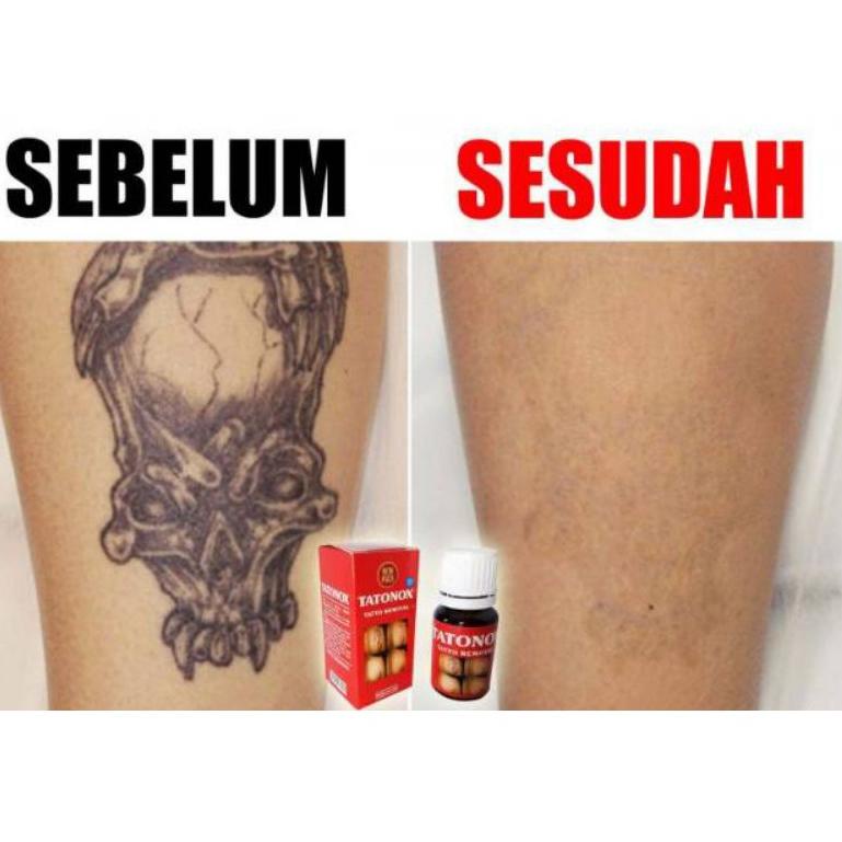 

COD || PnB PENGHAPUS TATO PERMANAEN ASLI ORIGINAL ||Diskon@promo