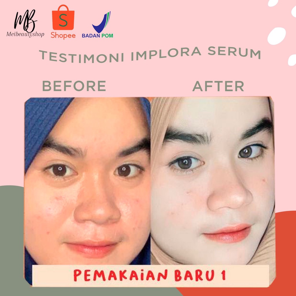 IMPLORA Serum Wajah 20 ML