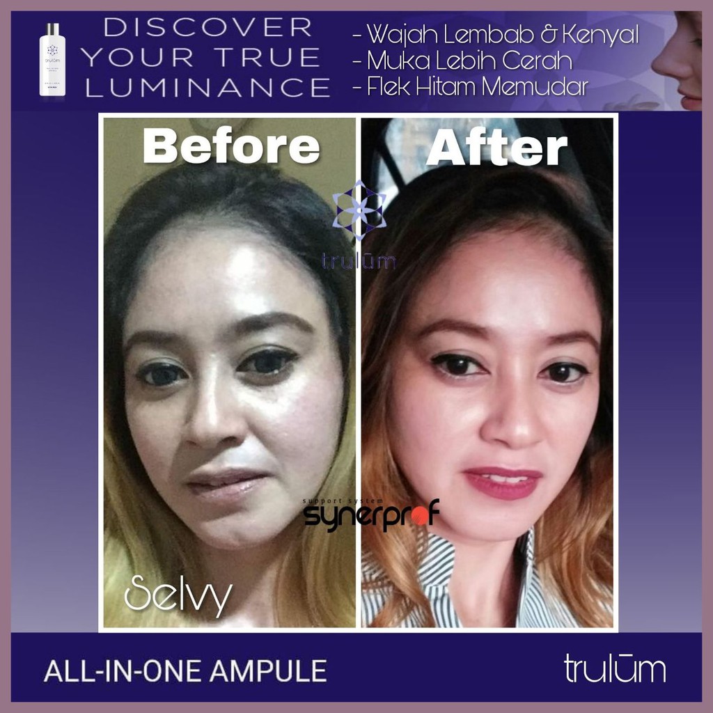 Cream Krim Wajah Kusam Pemutih Wajah Penghilang Keriput | Trulum 15ml