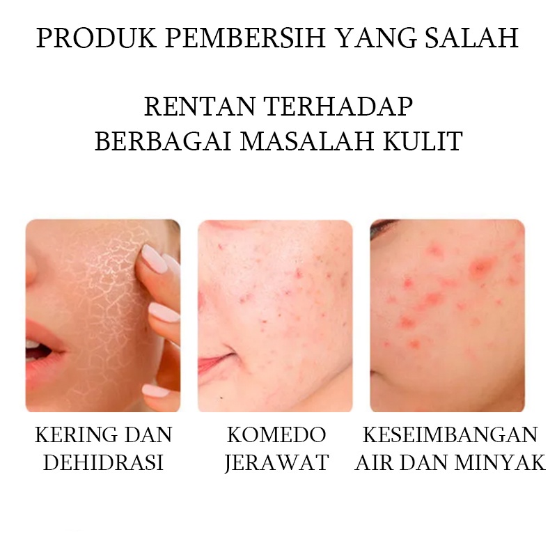 Masker pemutih wajah Masker Perawatan Jerawat Dalam Masker pelembab Masker jerawat dan bekas jerawat 150g Bahan lumpur alga Cleanser acne facial cleanser Kontrol Minyak Menyegarkan Tidak Sesak Deep Cleansing Penghapusan Komedo Penghapusan Jerawat