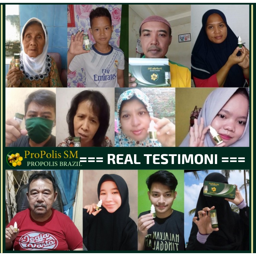 Salep Penghilang Selangkangan Hitam Akibat Jamur - Penghilang Gatel - Penghilang Bekas Kulit Lecet - Propolis SM 100% Original Alami-8