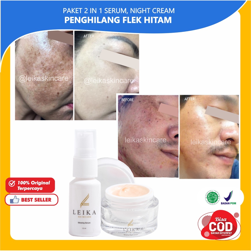 [2IN1 NIGHT,SERUM Flek Hitam] Paket Flek Hitam Membandel Menghilangkan Flek Hitam Di Wajah Ampuh Bpo