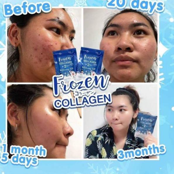 KEI FROZEN COLLAGEN 2 IN 1 WHITENING X10 ORIGINAL THAILAND -ASLI GLUTA FROZEN✵ (Laris)