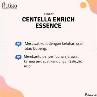 Centella Enrich Essence Pratista : Obat Penghilang Bopeng ...