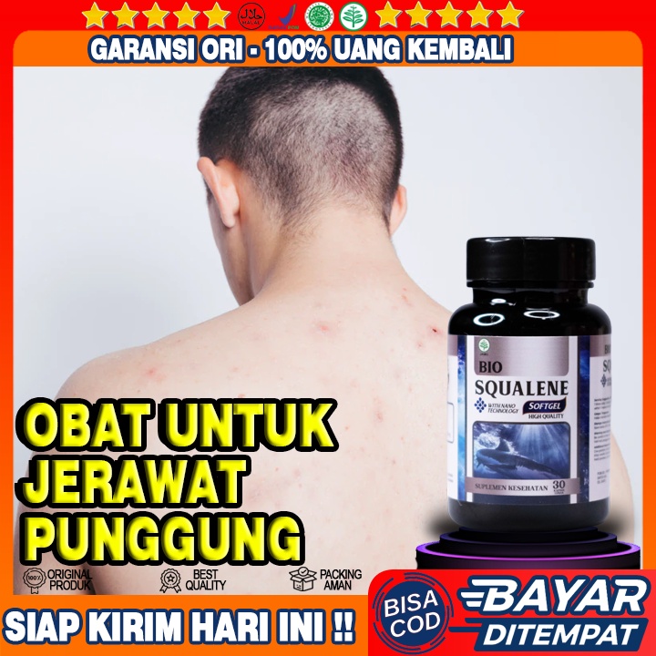 Obat Jerawat Punggung - Obat Bekas Jerawat Punggung - Obat Bintik Merah Punggung - Obat Jerawat Batu