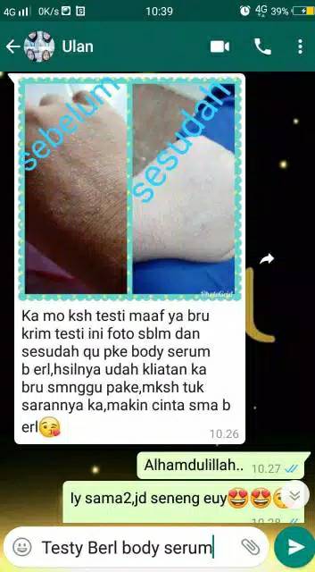 Body Serum B Erl Cosmetics | Pencerah Kulit Tubuh Pudarkan Bekas Luka