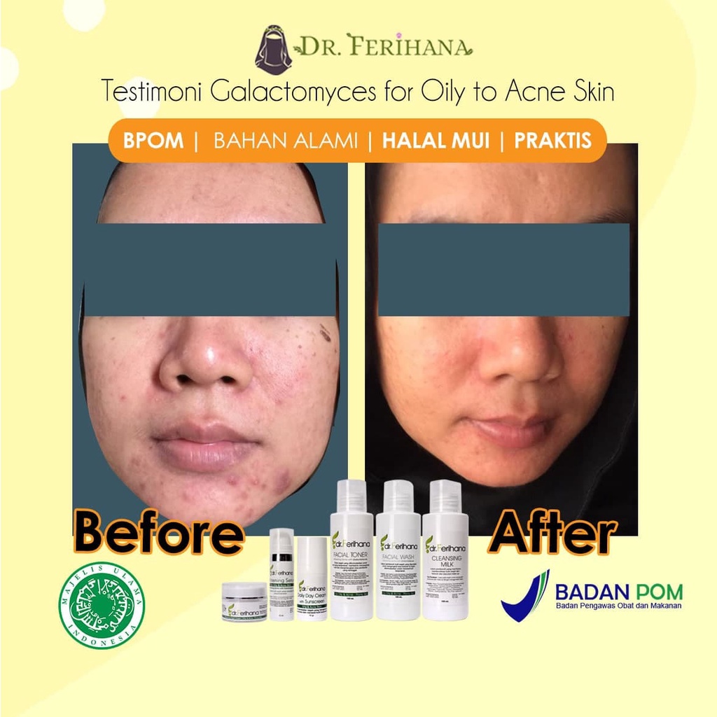 Galactomyces Night Cream For Oily &amp; Acne DR. FERIHANA COSMETICS &amp; SKINCARE Merupakan Krim Malam untuk Kulit Berminyak Berjerawat Flek Hitam Mencerahkan Sekaligus Anti Aging BPOM LPPOM HALAL MUI