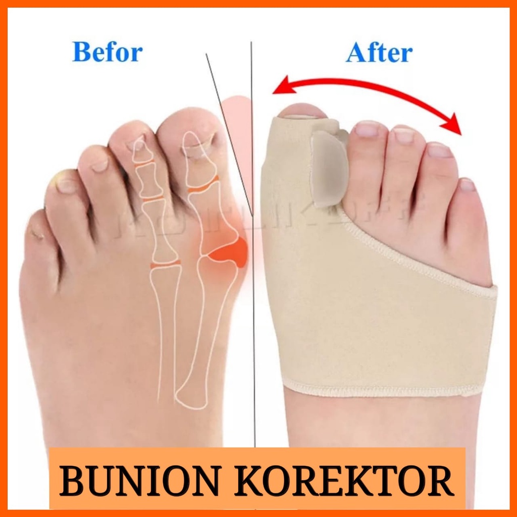 1 Pasang Korektor Tulang Jempol Bunion Hallux Orthotics / Separator Insole Kain Super Lembut