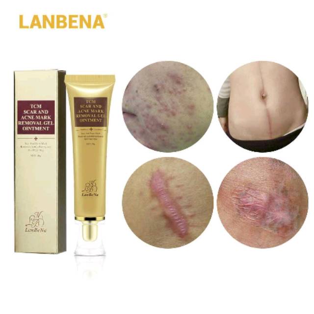 Lanbena TCM Scar and Acne Mark Removal Gel Ointment /penghilang bekas jerawat