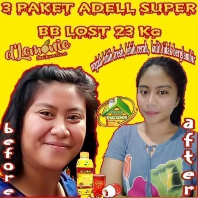 PAKET ADEL SUPER 2 LEMON + 1 BOTOL APEL SUPER