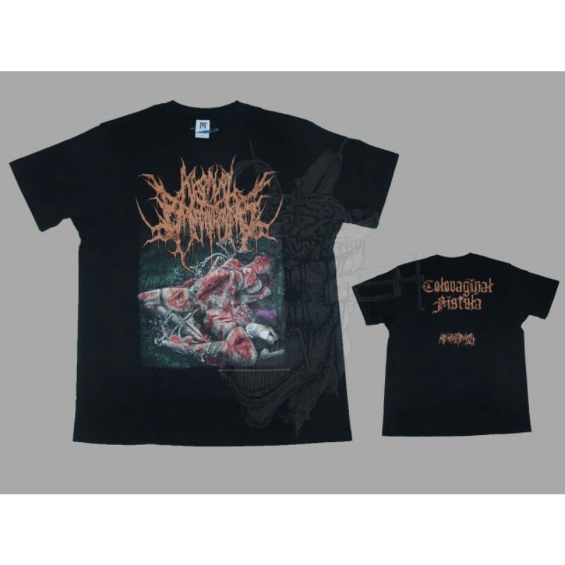 tshirt agonal breathing - colovaginal