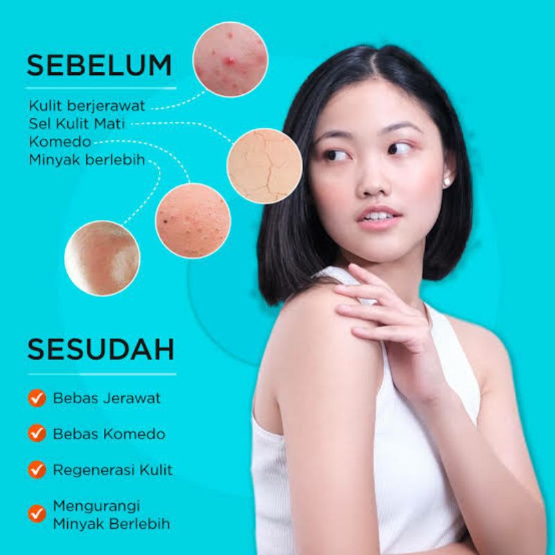 ERHA ACNE CARE LAB ACNE CLEANSER SCRUB BETA PLUS (ACSBP) SABUN UNTUK WAJAH BERJERAWAT